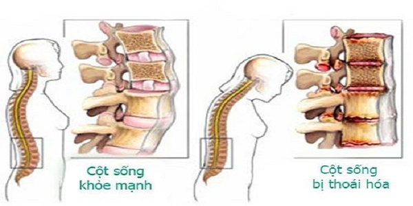 thoai hoa cot song
